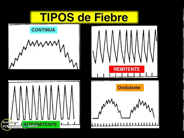 Fiebre Continua: Gráfica, Duración, Tipos y Tratamiento - Cuánto dura la fiebre continua fiebre continua grafica - Cuánto dura la fiebre continua