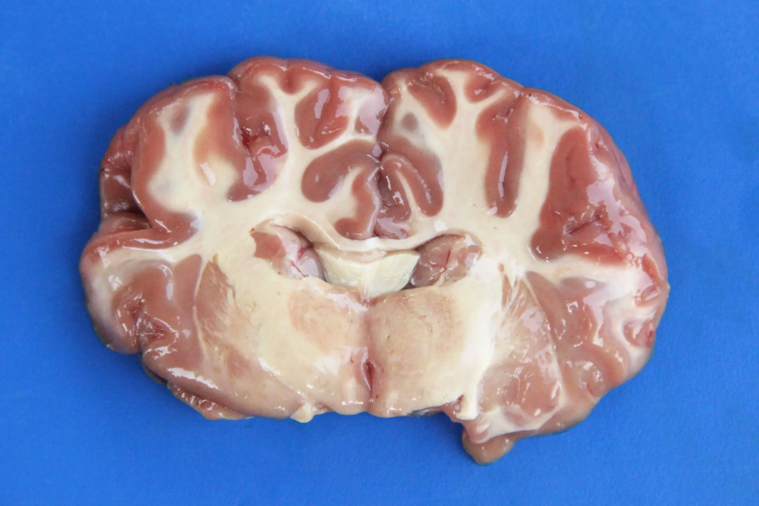 <b>Babesia bovis</b> e Imprenta Cerebral: Un Análisis Profundo - Qué causa la piroplasmosis bovina babesia bovis imprenta cerebral - Qué causa la piroplasmosis bovina
