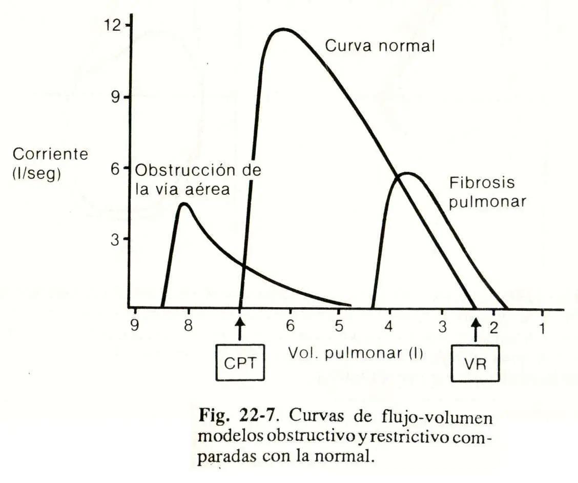 Alteraciones Gráficas: Un Análisis Exhaustivo - Qué es la variación en una gráfica alrteracion grafica - Qué es la variación en una gráfica