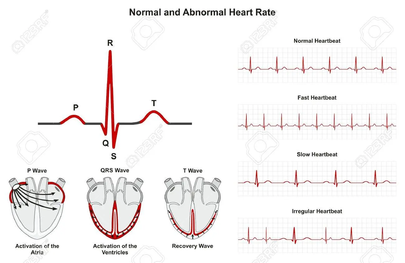 Gráfica de Pulsaciones: Guía Completa para Entender tu Ritmo Cardíaco - Qué ritmo cardíaco es preocupante grafica de pulsaciones - Qué ritmo cardíaco es preocupante